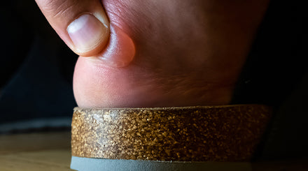 Understanding and Preventing Foot Blisters