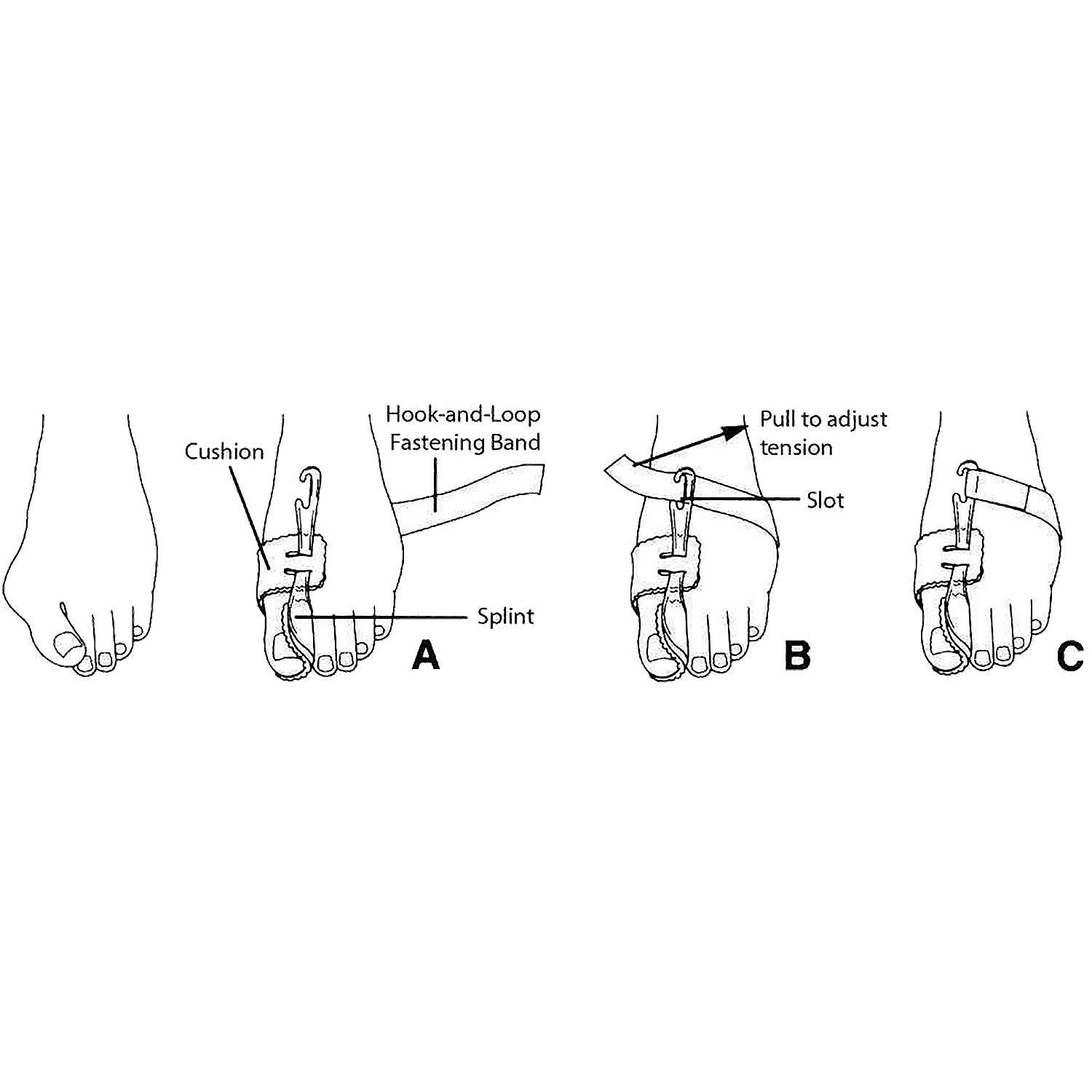 Unisex Pedifix Unisex PediFix Nighttime Bunion Regulator