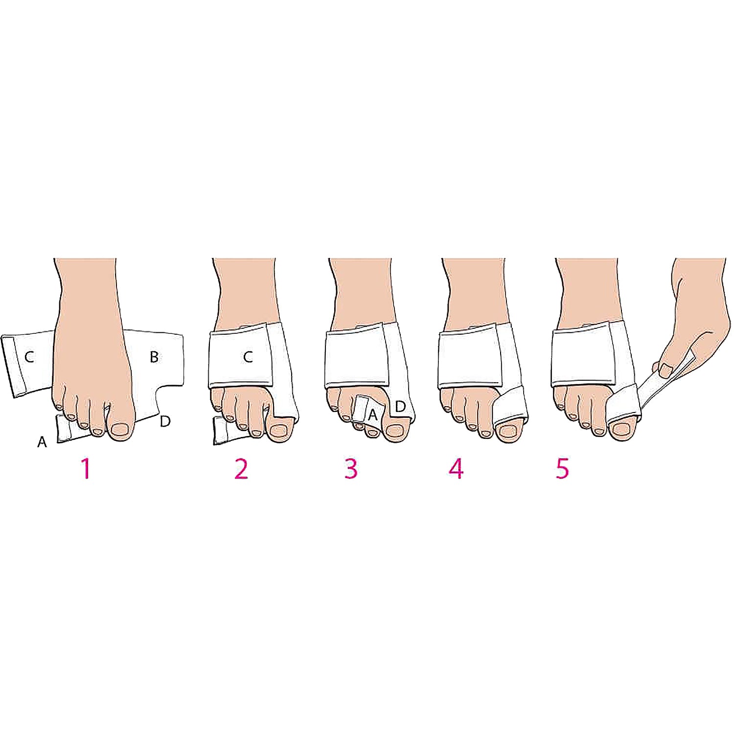 Unisex Pedifix PediFix Bunion SoftSplint Unisex Fabric Foot Splint